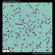 streptococcus pneumoniae under microscope